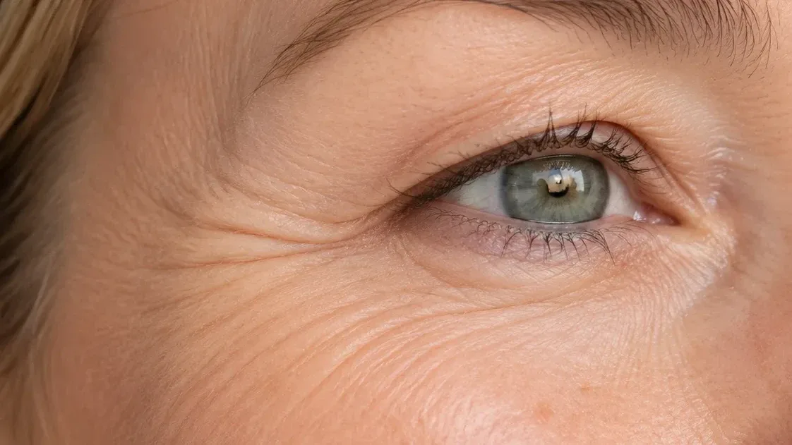Wrinkles & Fine Lines