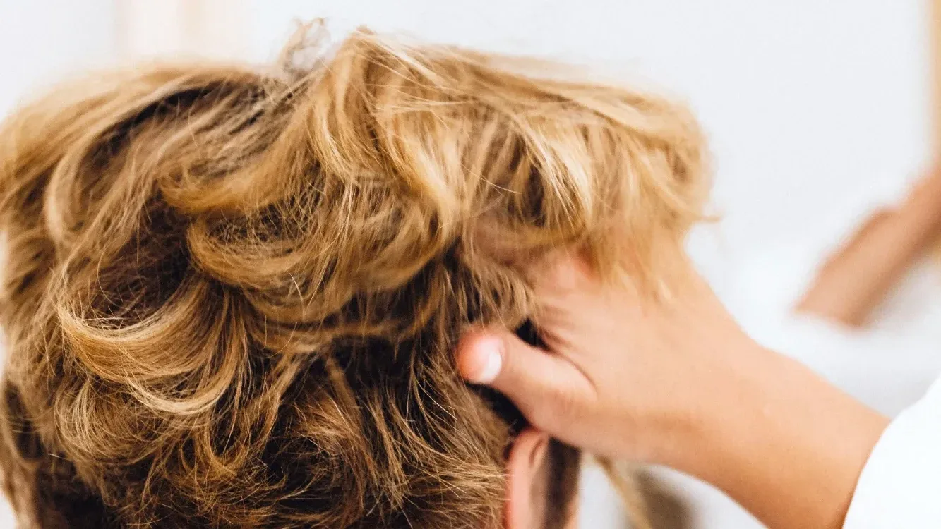 Hair Loss & Thinning — condition