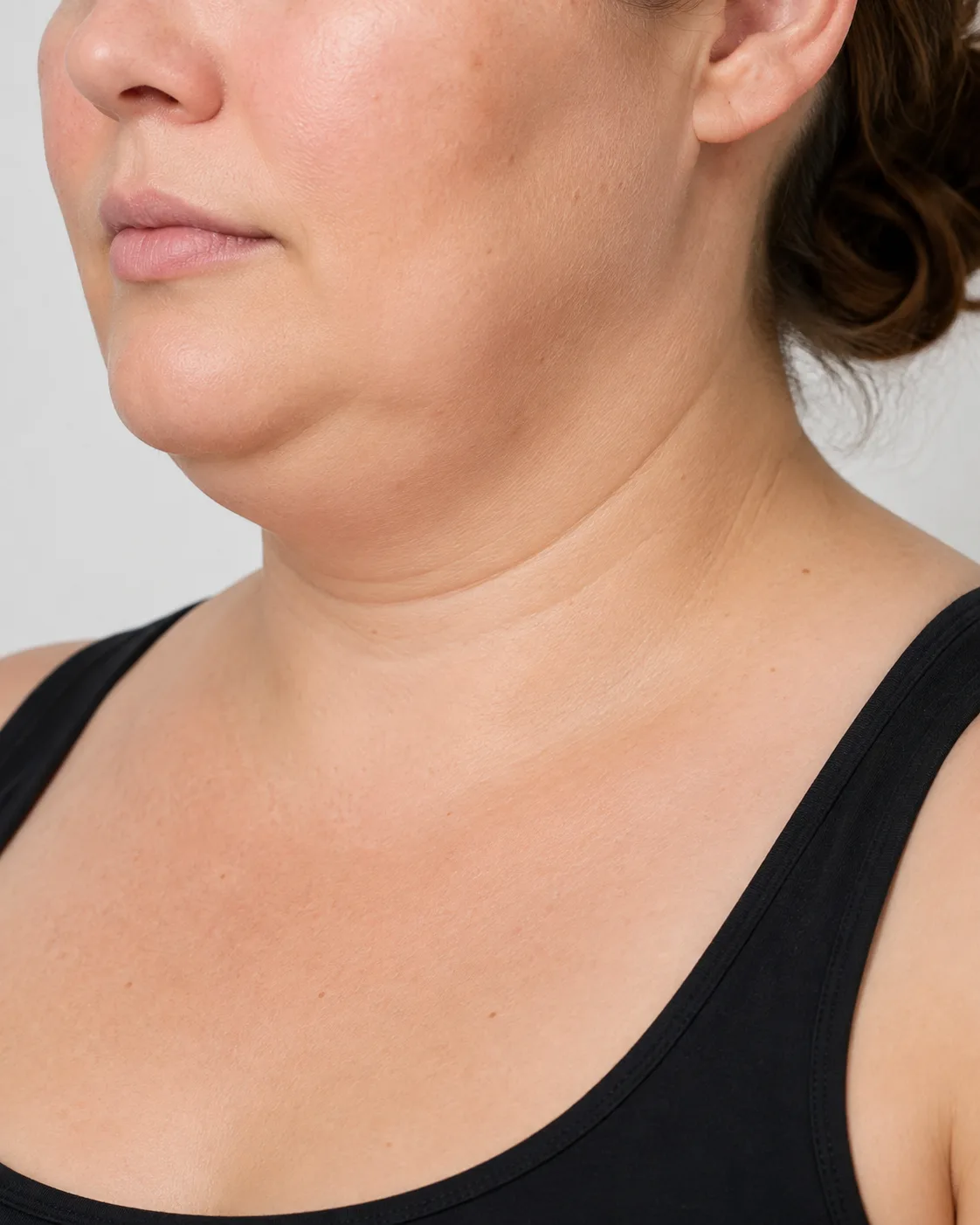 Reduced jawline definition