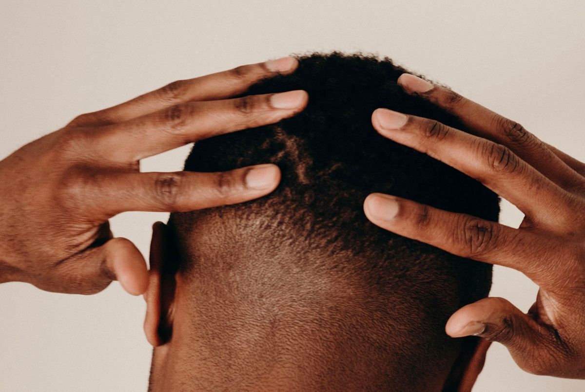 Hair Loss & Thinning — in clinic