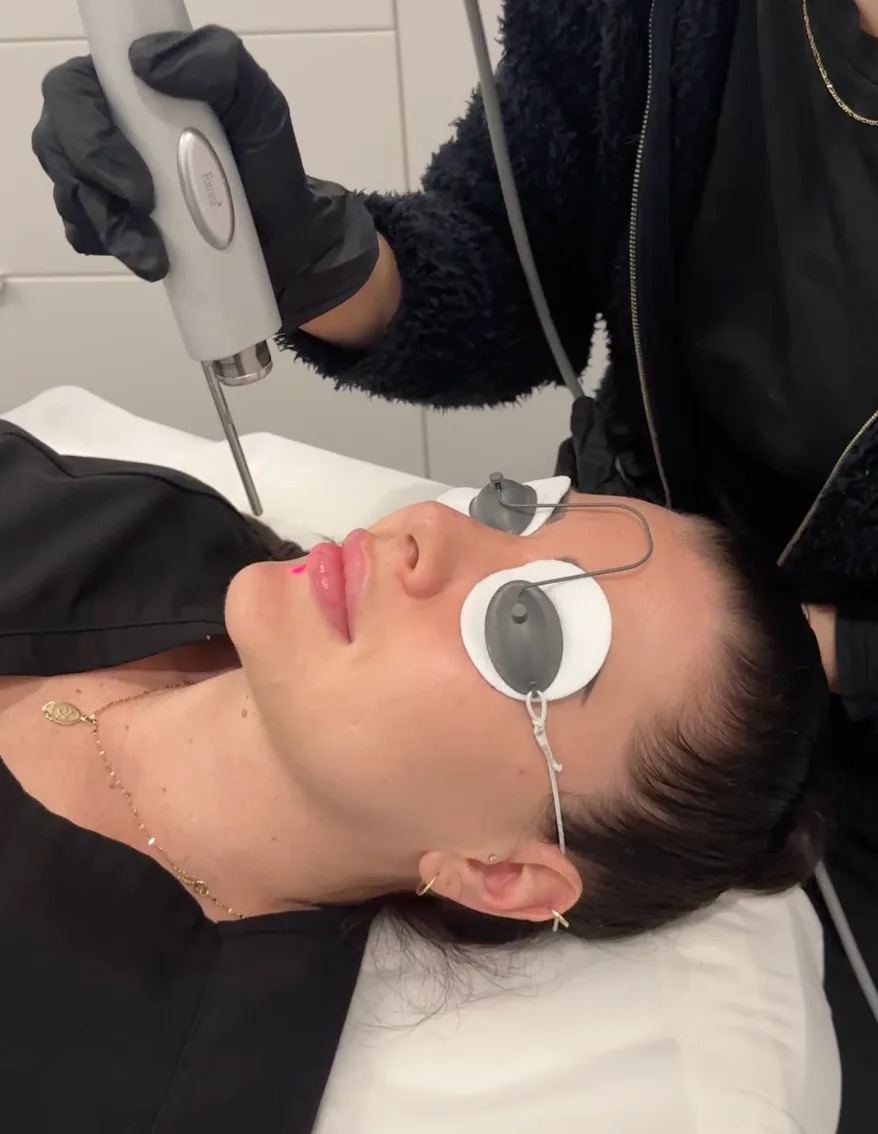 Discoloration Correction — treatment