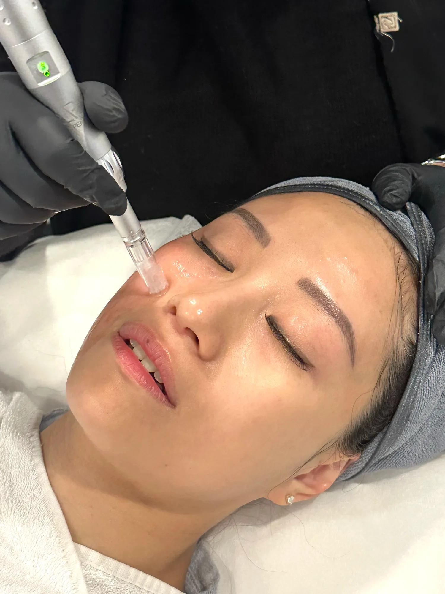 Collagen & Lifting — in clinic