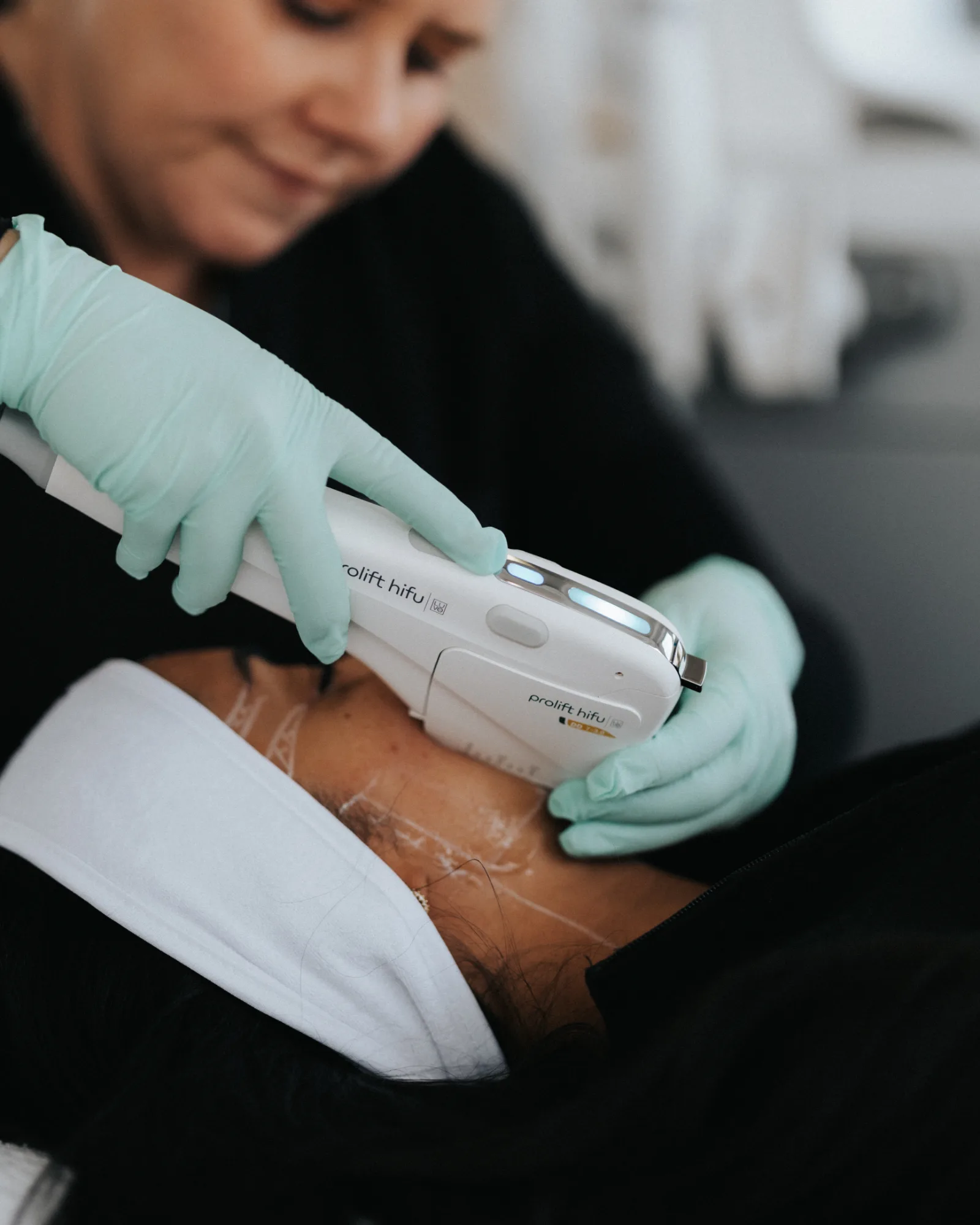 HIFU Skin Tightening — treatment