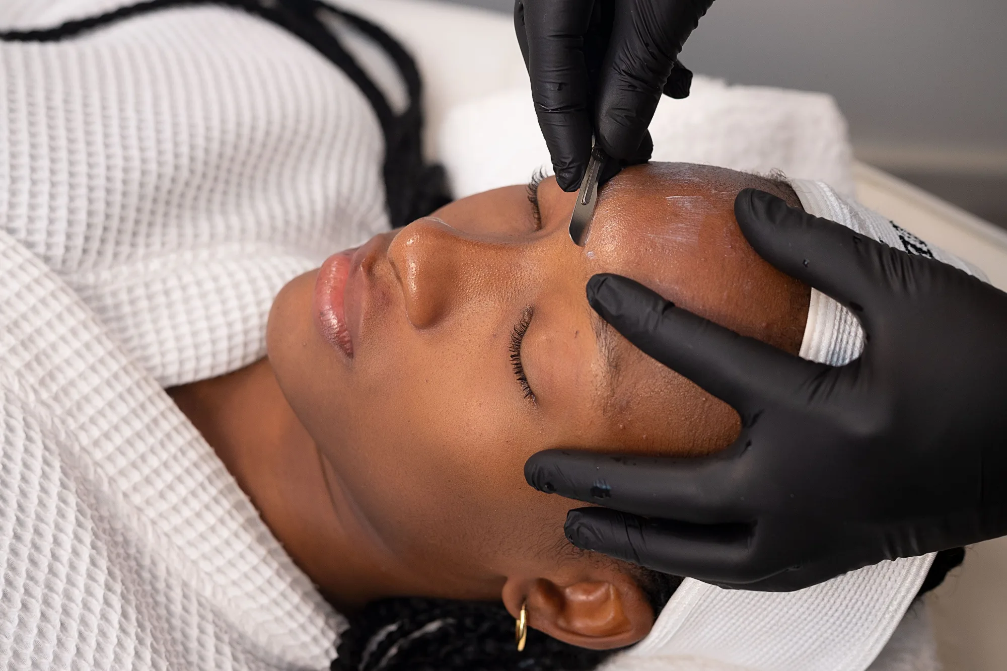 Dermaplaning — treatment