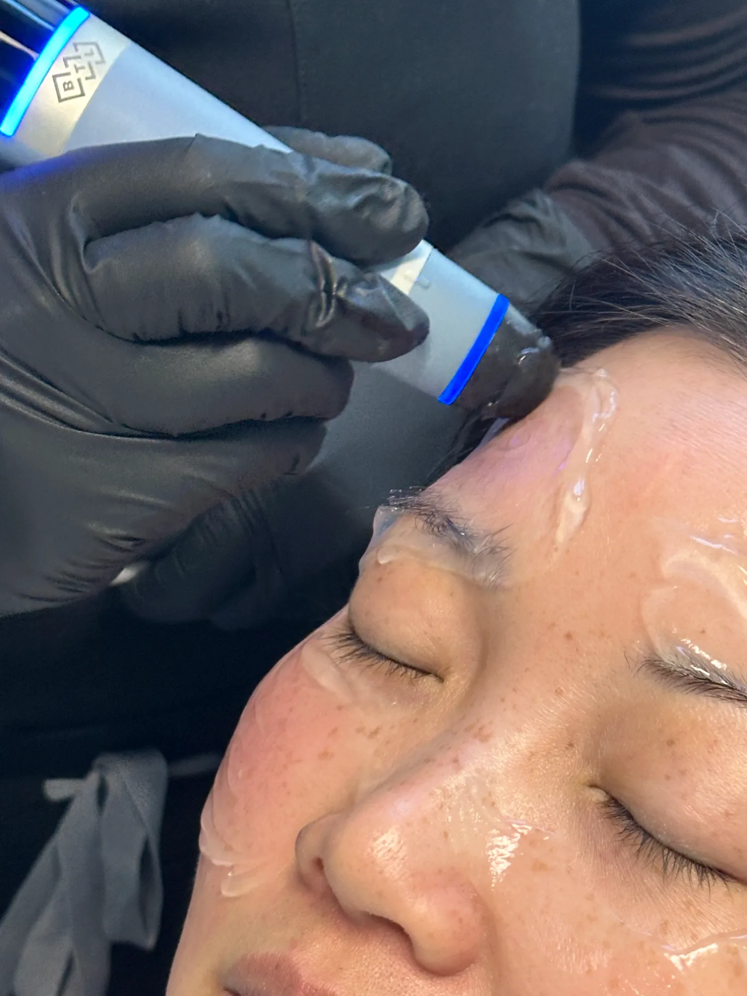 Collagen & Lifting — in clinic