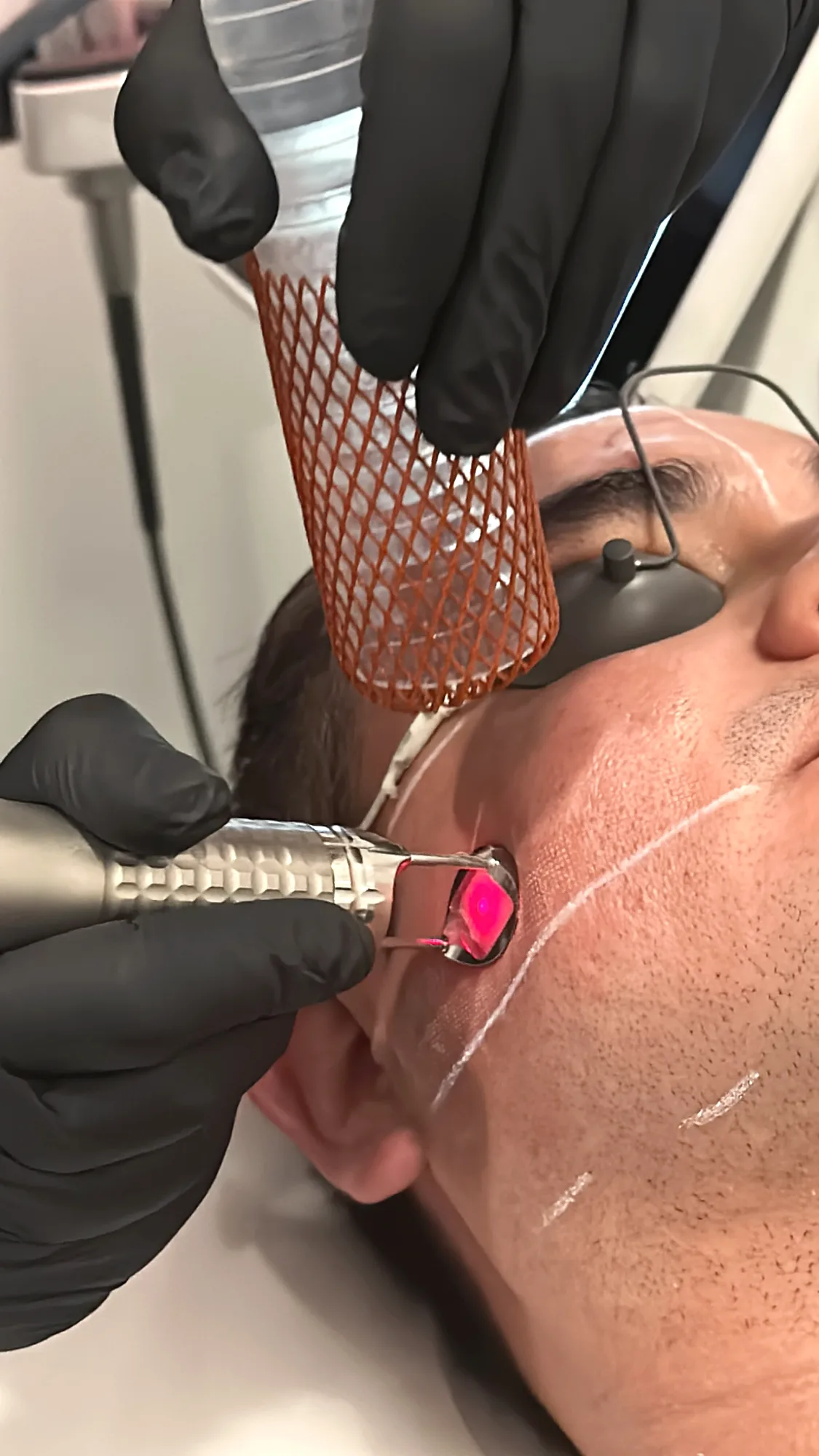Rebuild Resurfacing Treatment — treatment