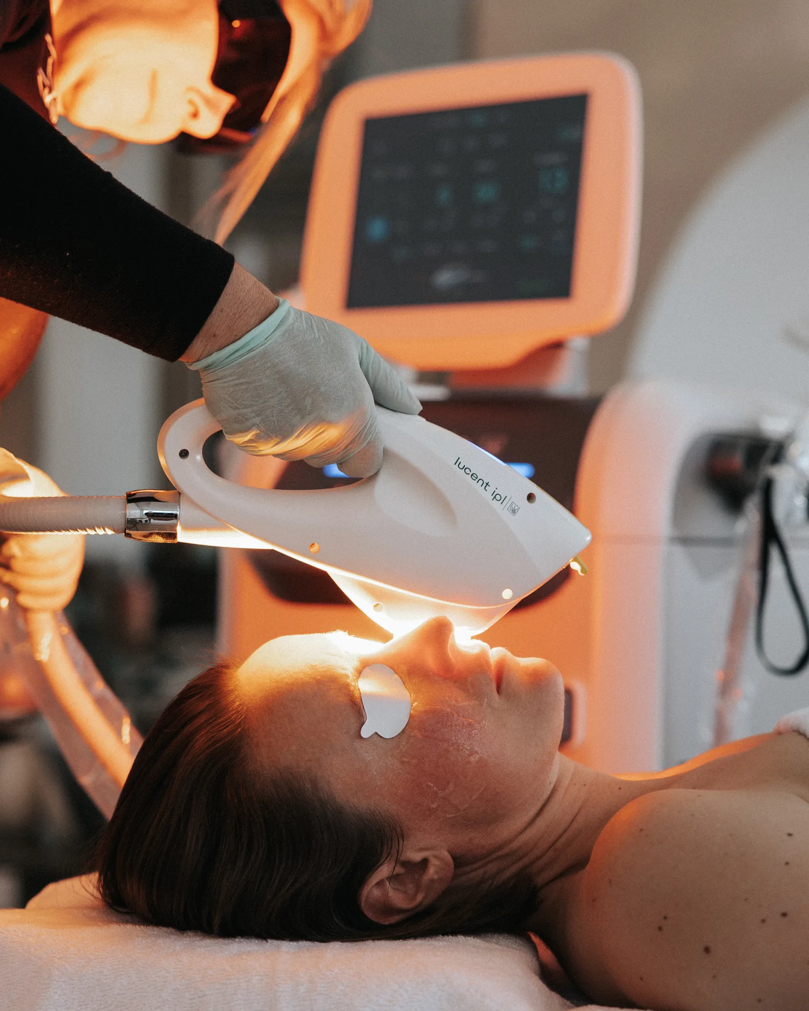 Laser — in clinic