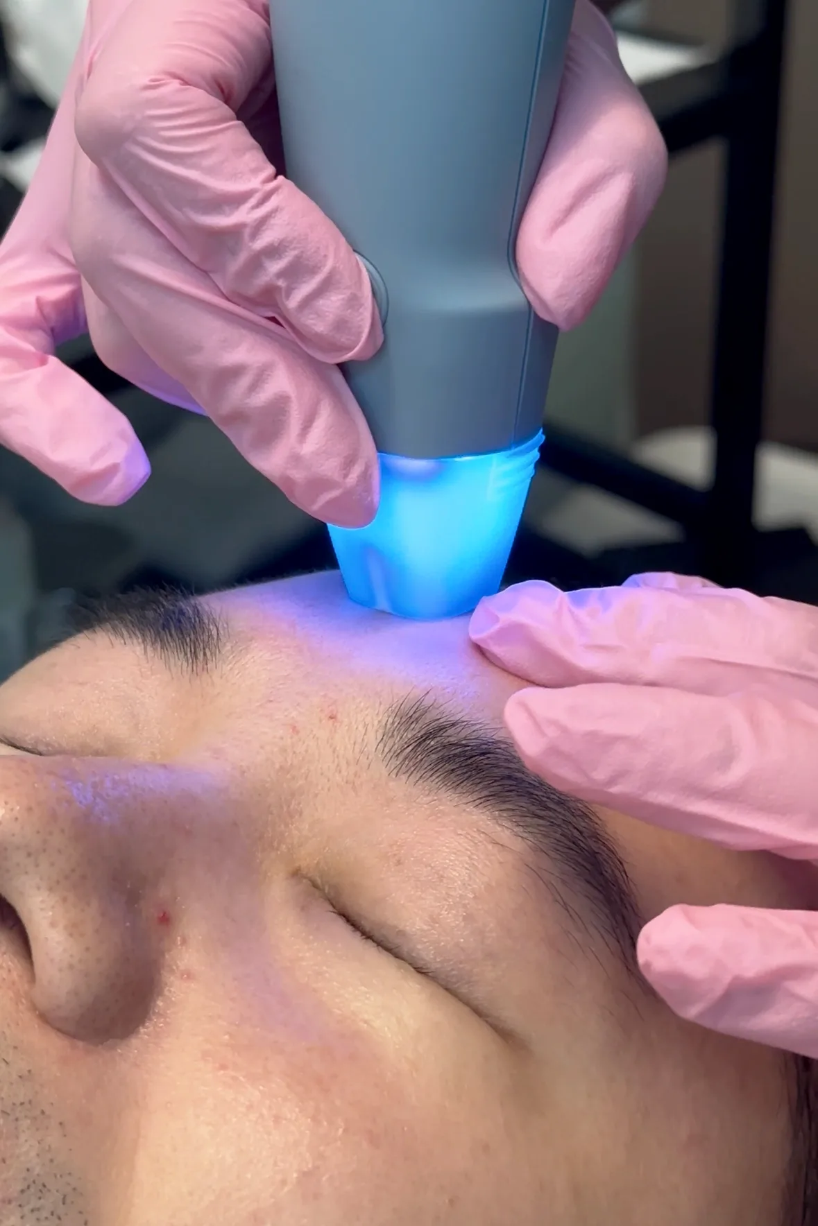 Collagen & Lifting — in clinic