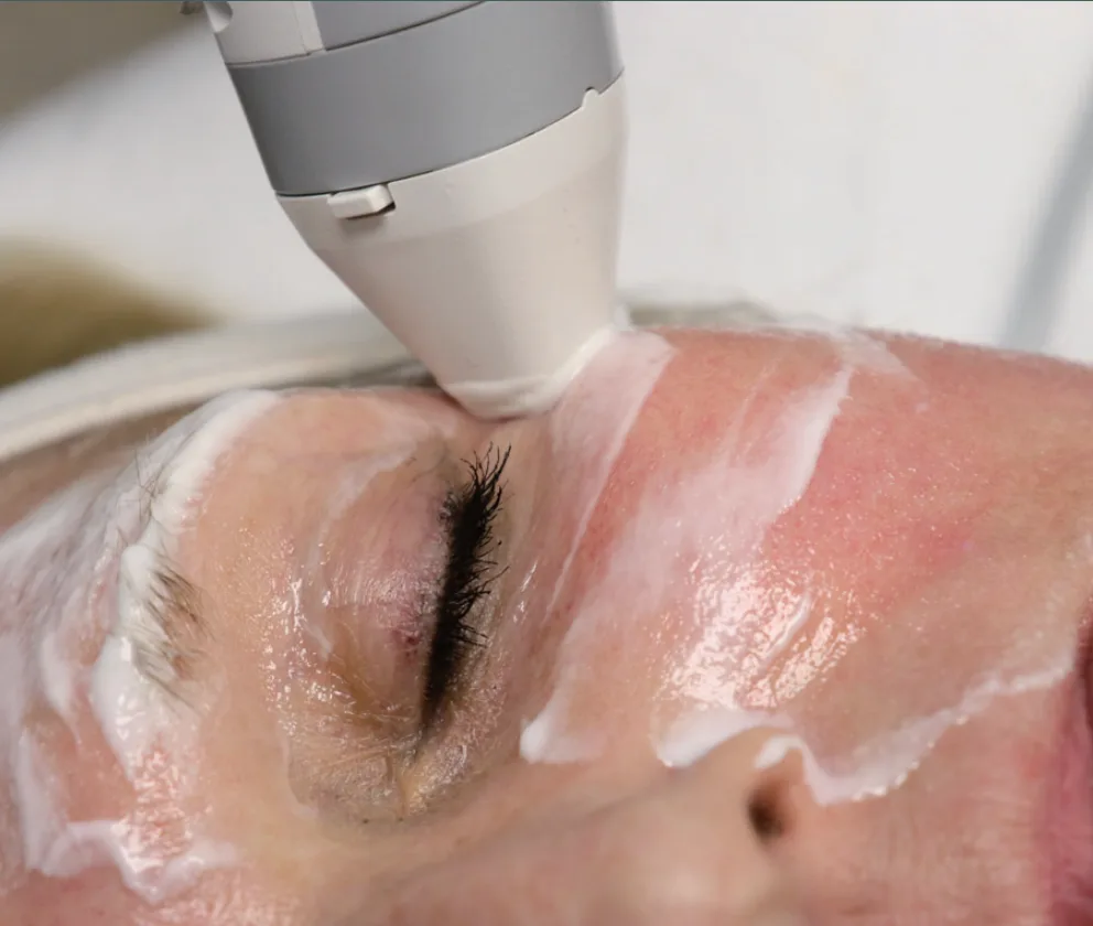 Advanced Dry Eye Treatment — treatment