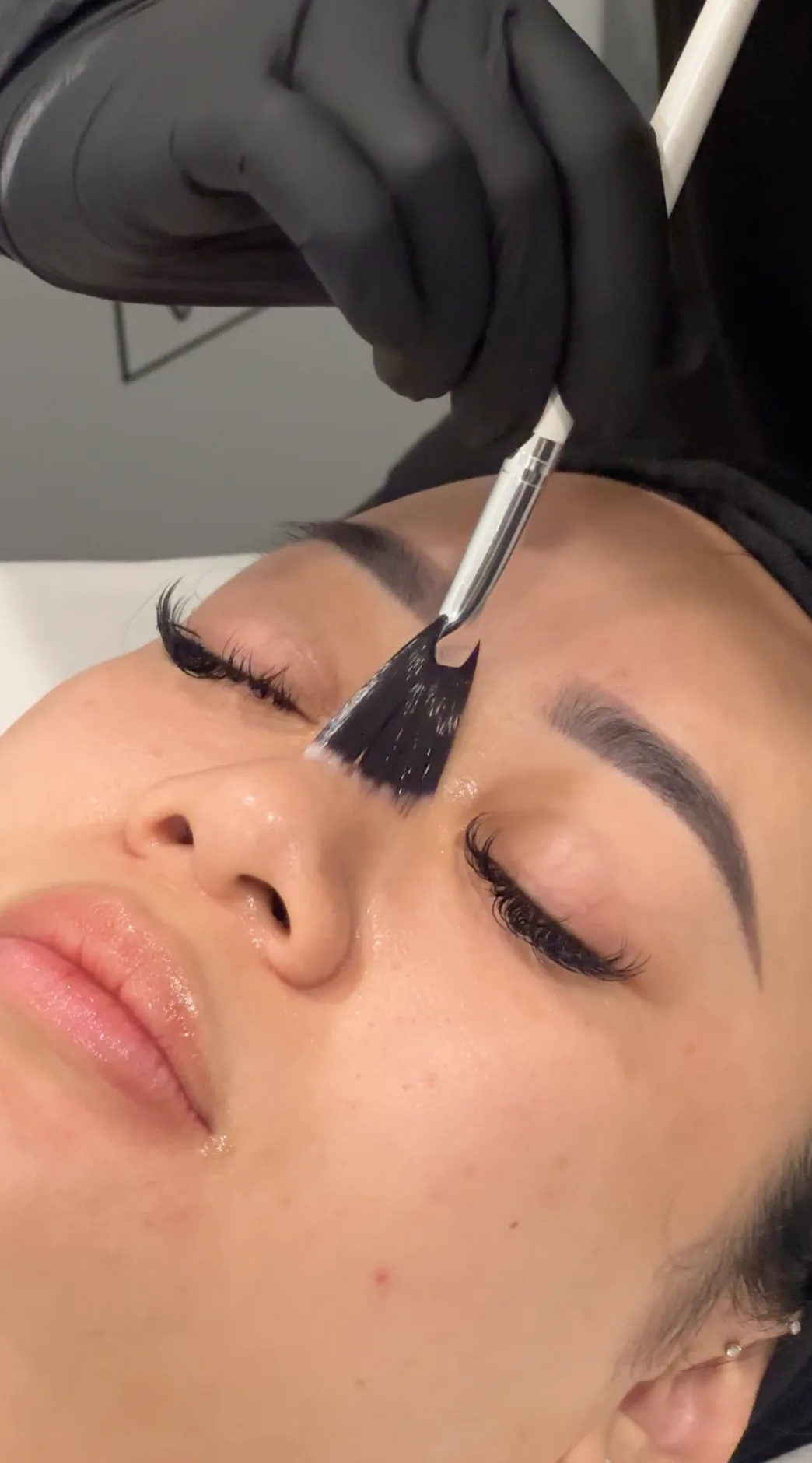 MandeliClear Peel — treatment