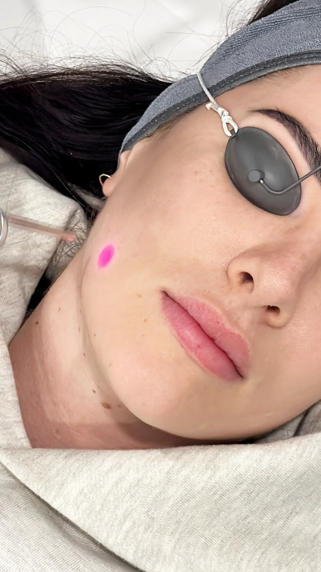 Blemish Repair — treatment