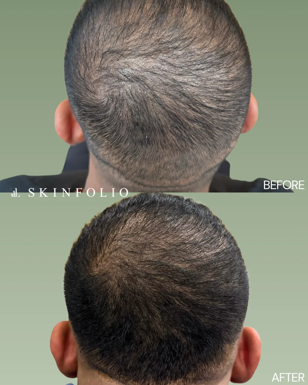 Before and after result
