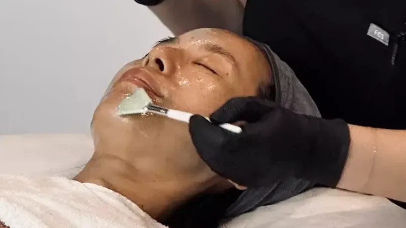 Glow Peel — treatment