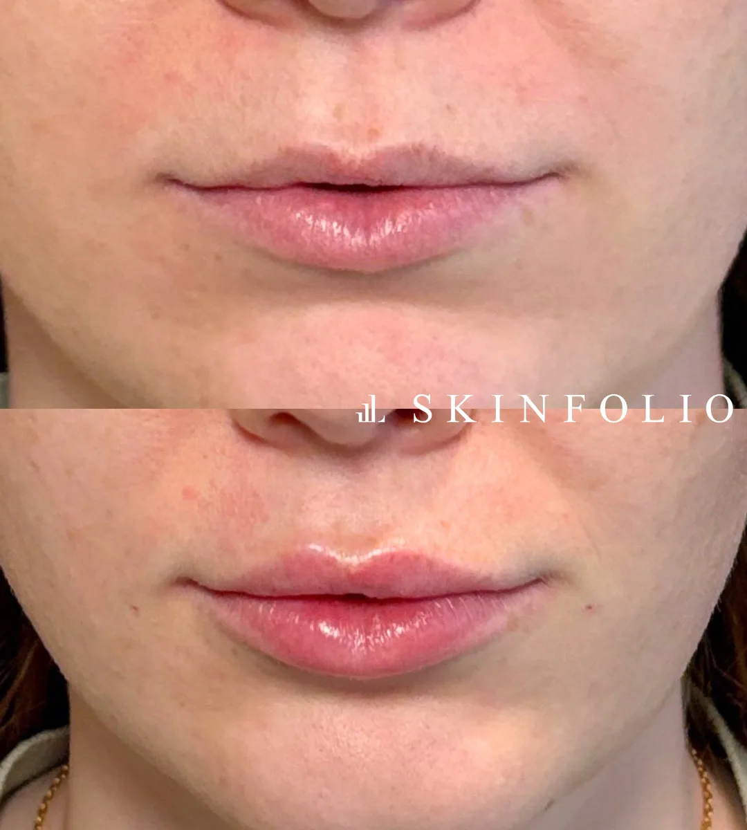 Before and after result