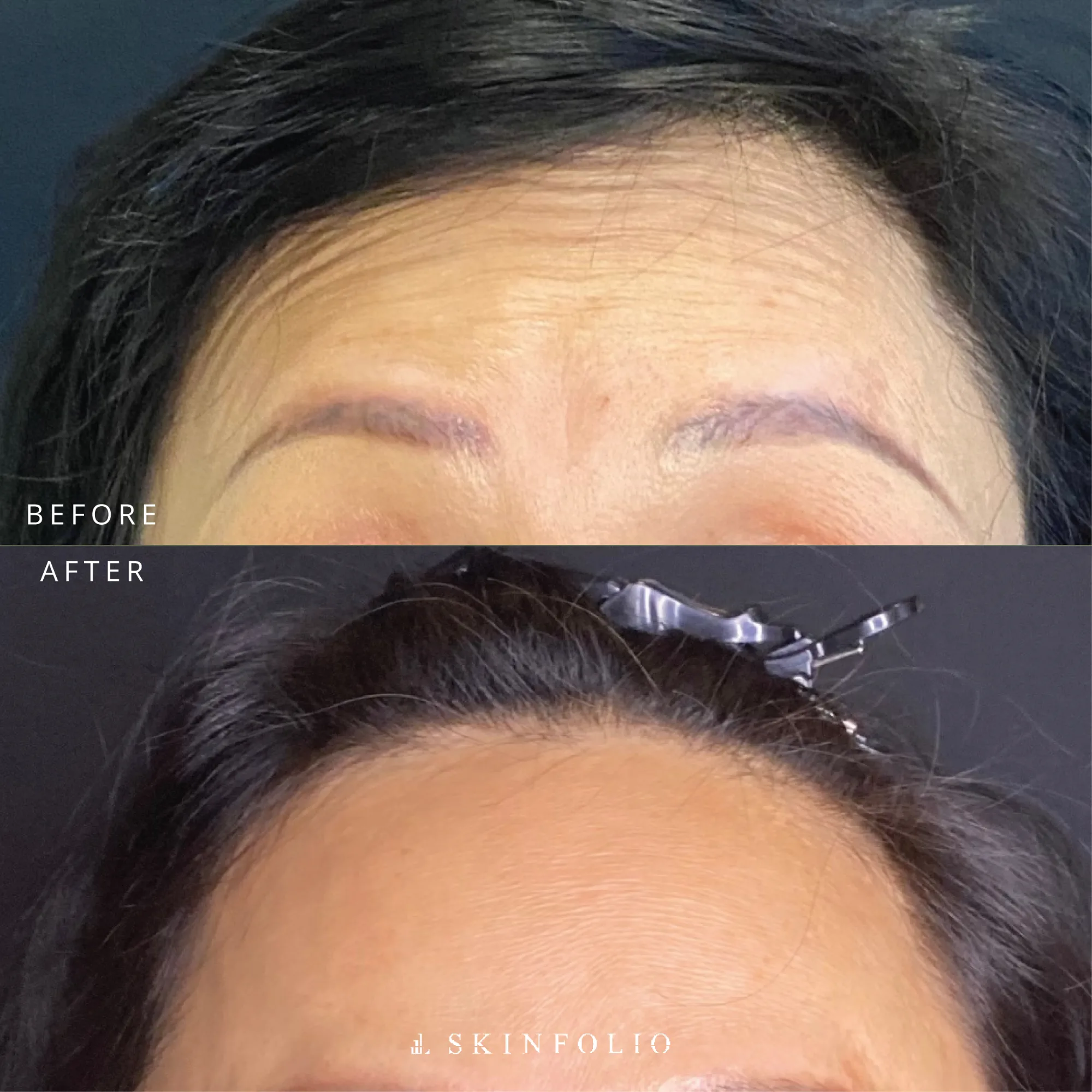 Before and after result