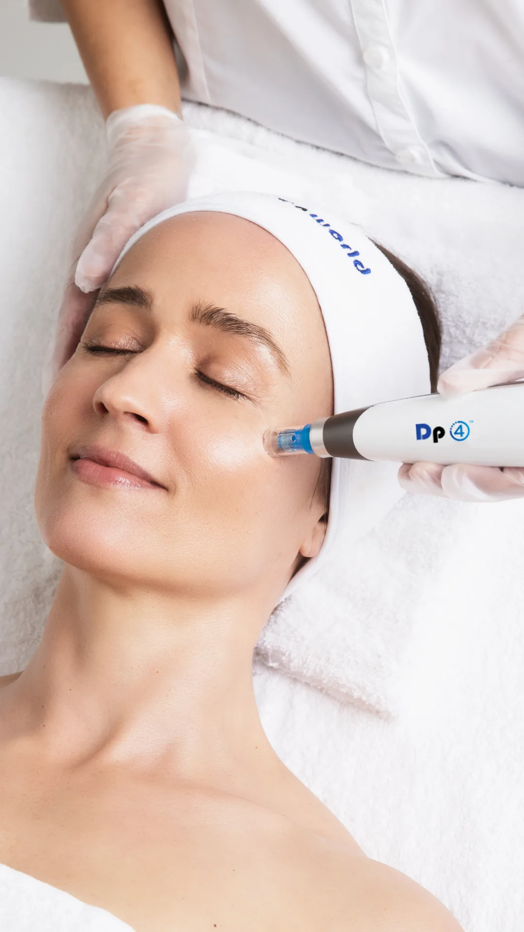 Microneedling — treatment