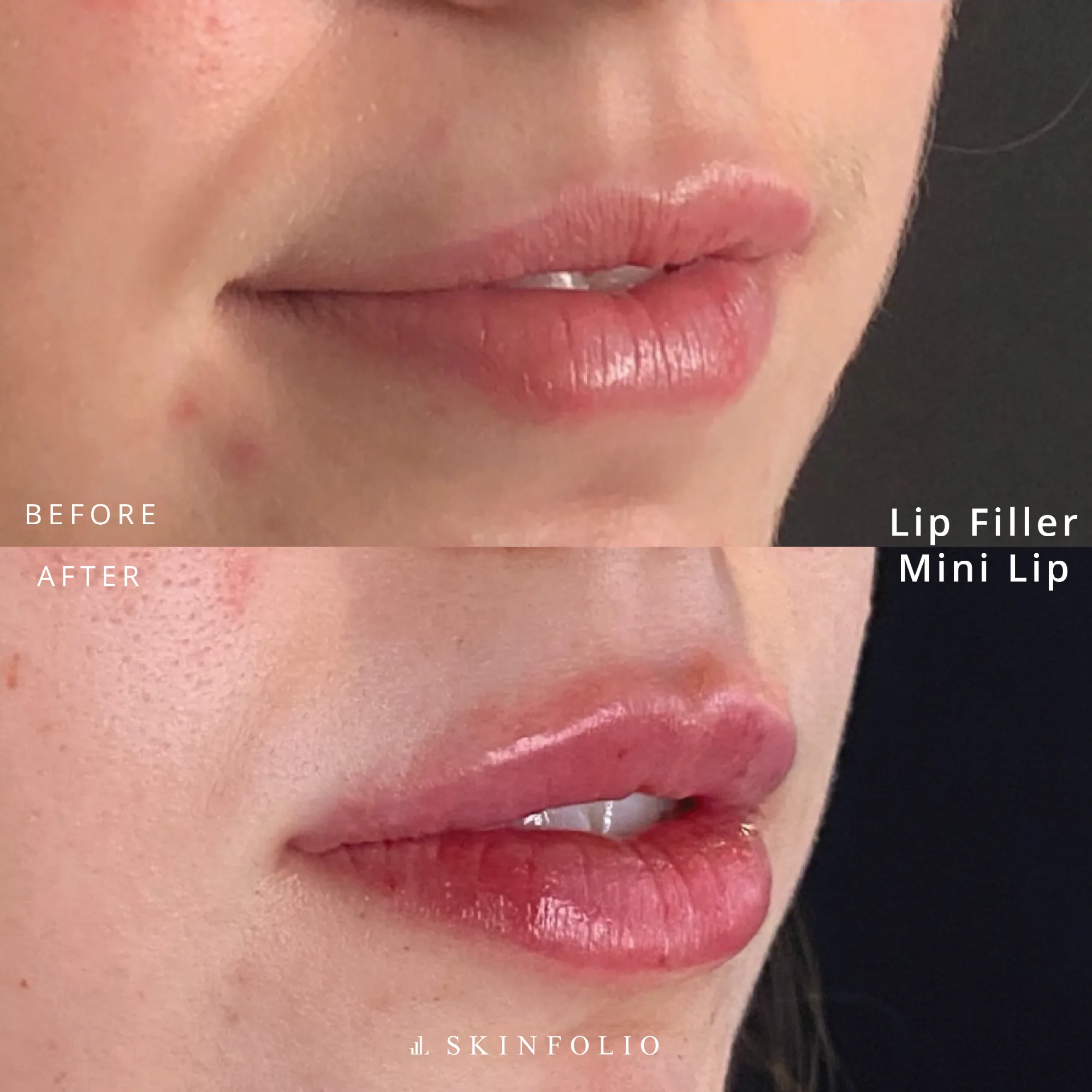 Before and after result