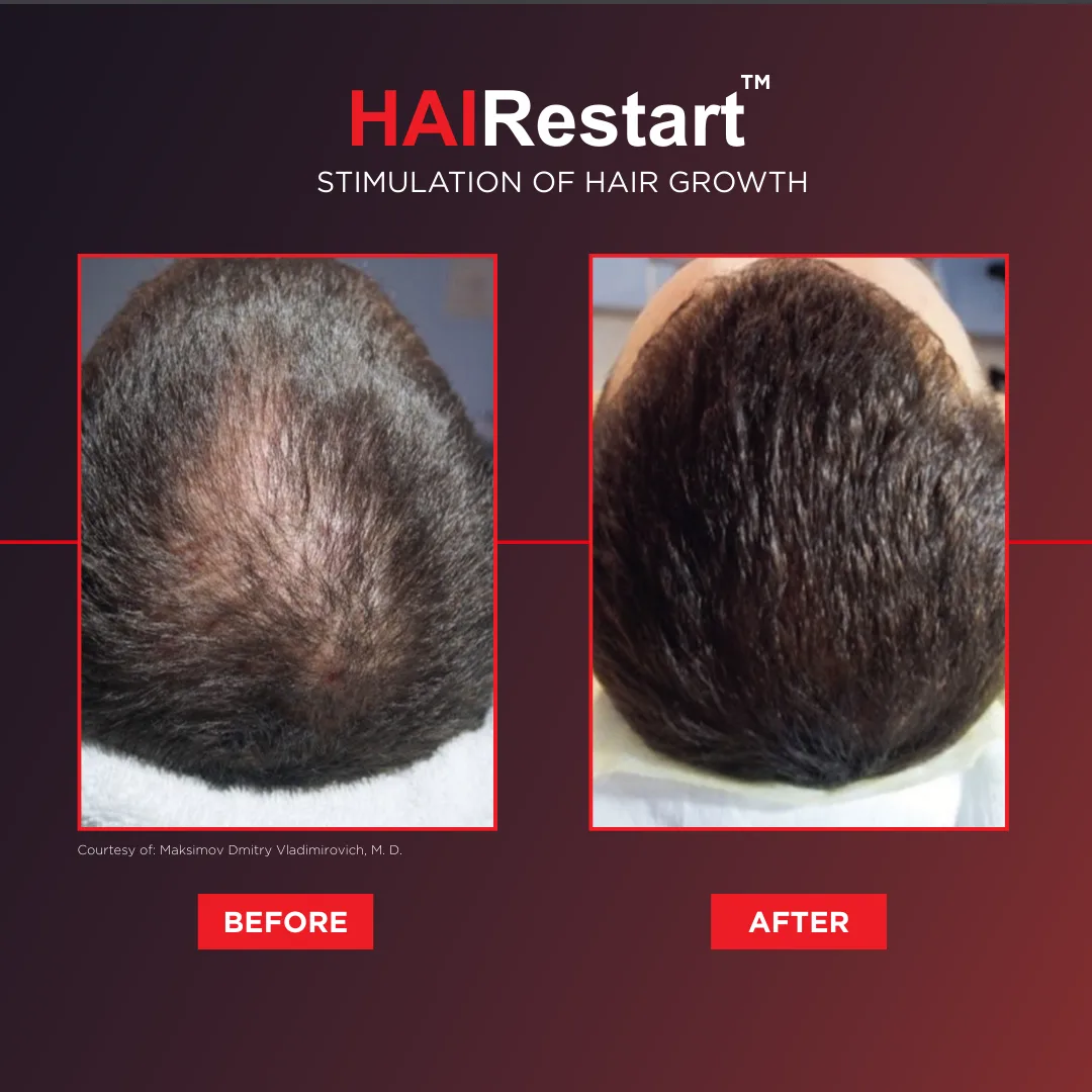 Before and after result