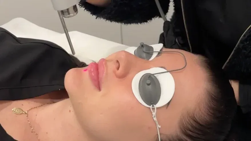 Discoloration Correction — treatment