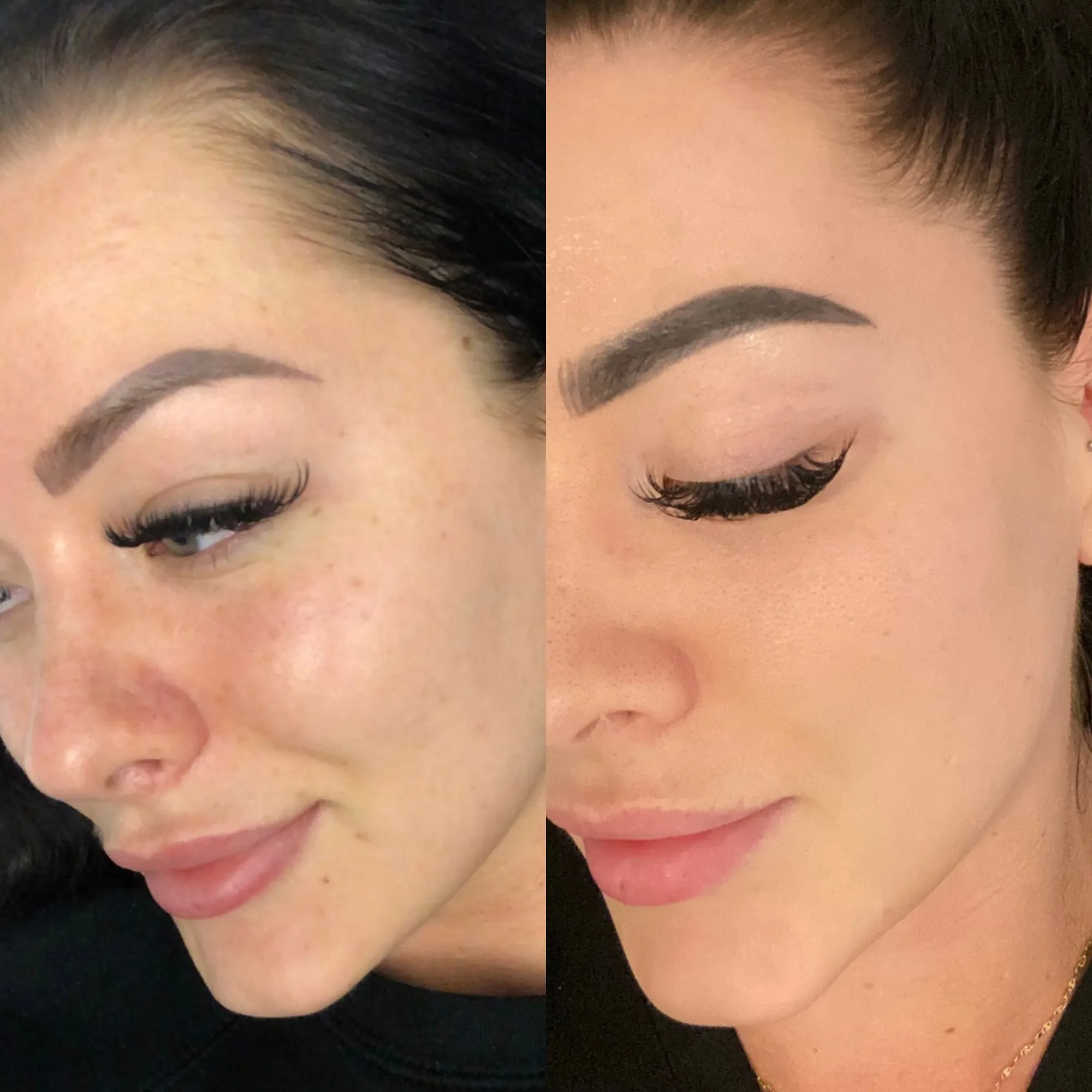 Before and after result