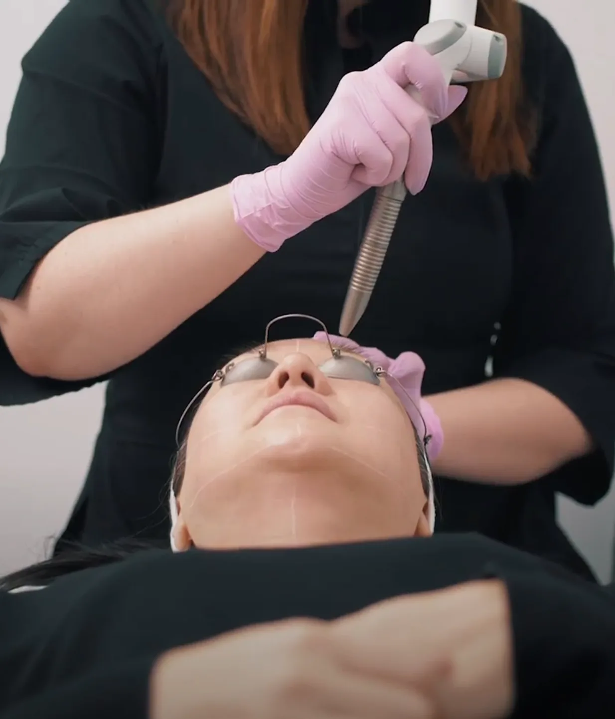 Laser — in clinic