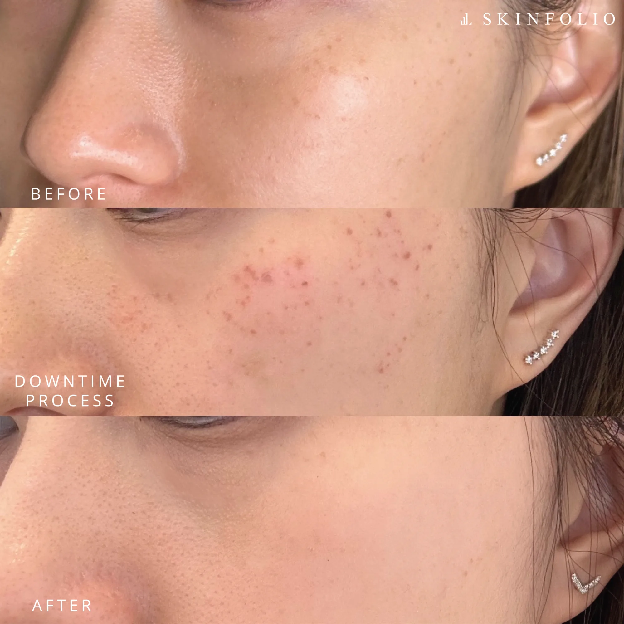 Before and after result