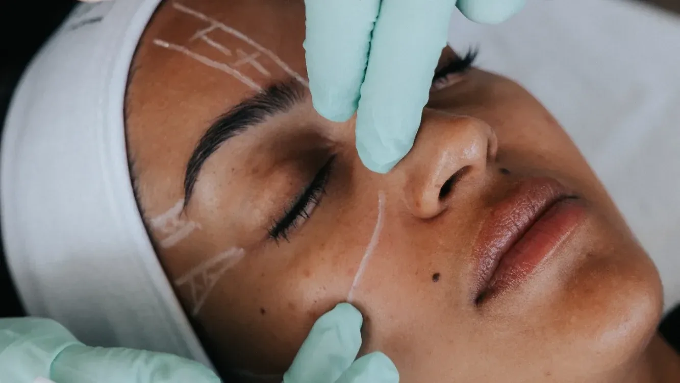 HIFU Skin Tightening — treatment
