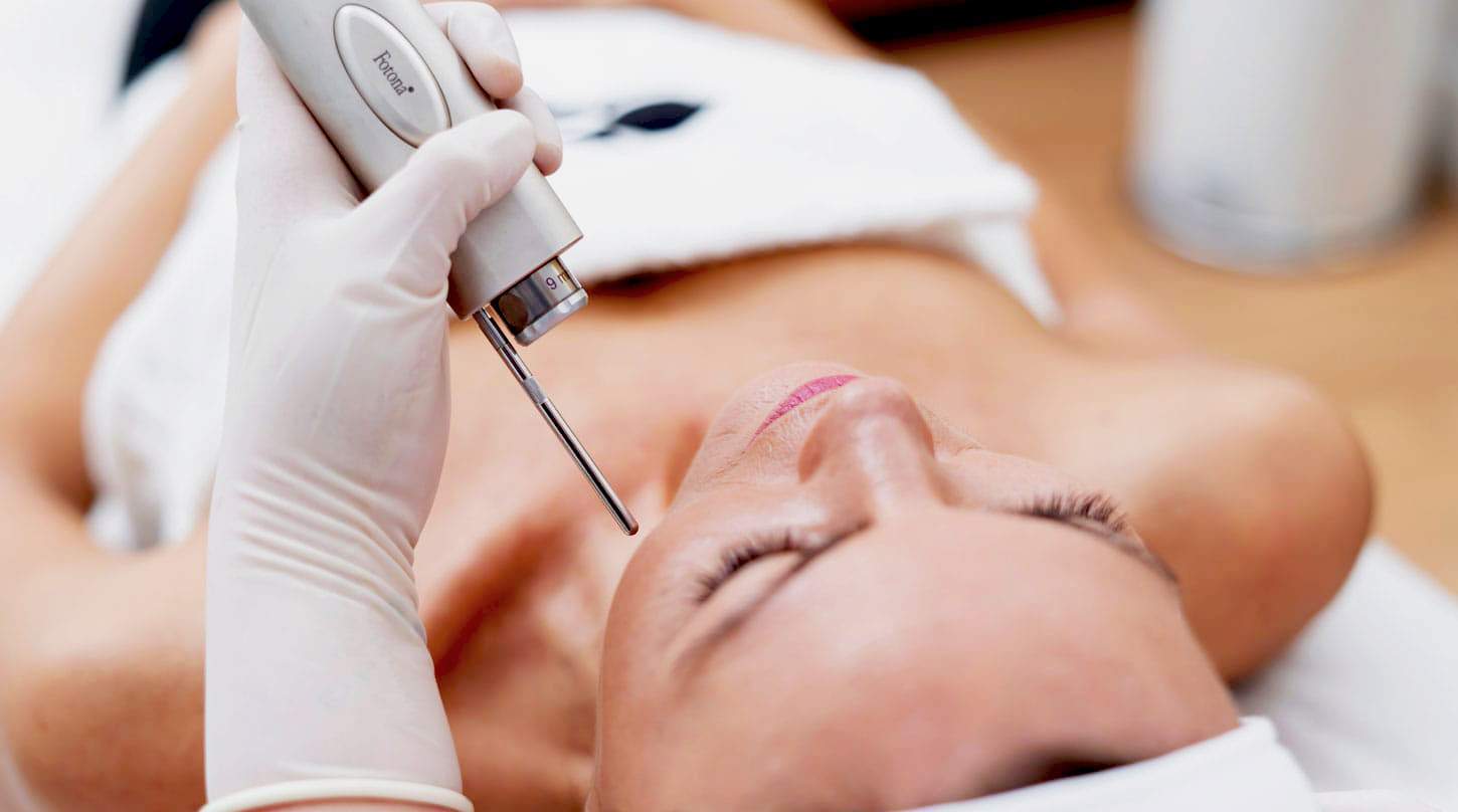 Laser — in clinic