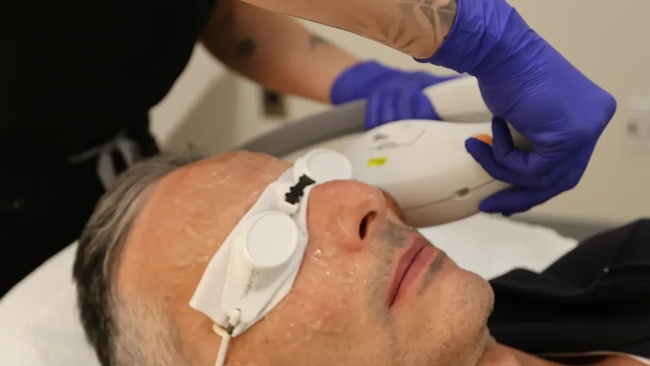 Laser — in clinic